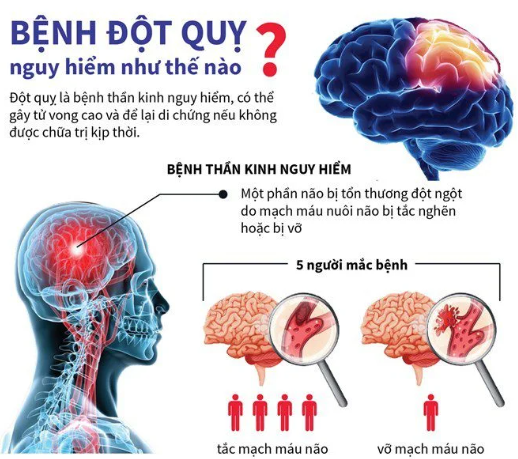 Top bệnh nền tăng nguy cơ đột quỵ: Bạn có đang mắc phải những căn bệnh này?