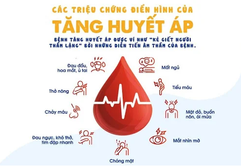 Các yếu tố nguy cơ gây thiểu năng tuần hoàn não rất ít người biết