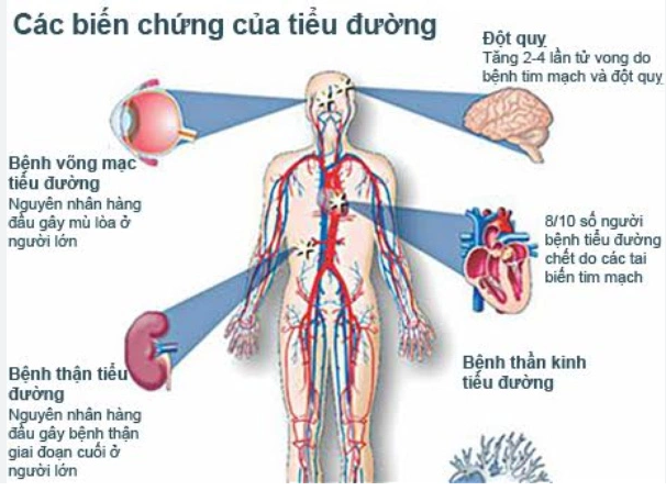 Đột quỵ ở bệnh nhân tiểu đường: Mối nguy hiểm không thể xem nhẹ