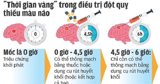 Cấp cứu đột quỵ: Vì sao “thời gian vàng” là chìa khóa cho sự sống?