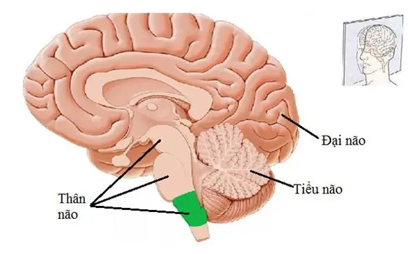 Đột quỵ thân não là gì? Có chữa trị được không?
