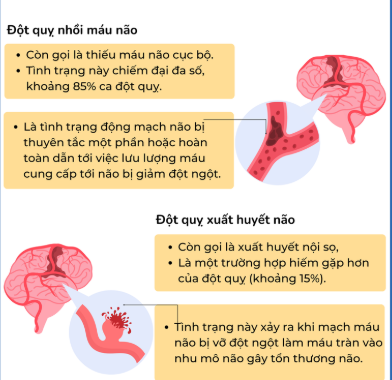 Đột quỵ tái phát sau bao lâu? Bí quyết phòng ngừa đột quỵ tái phát