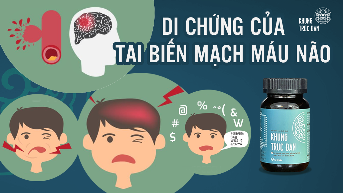 Di chứng của tai biến mạch máu não: Những ảnh hưởng lâu dài không nên chủ quan