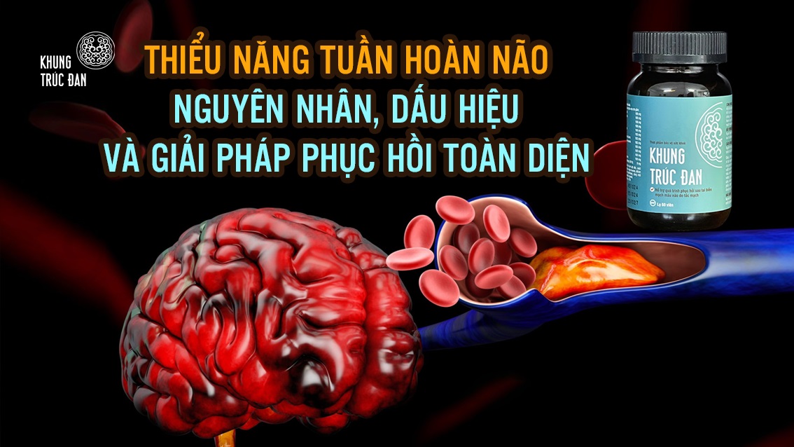 Thiểu năng tuần hoàn não: Nguyên nhân, dấu hiệu và giải pháp phục hồi toàn diện